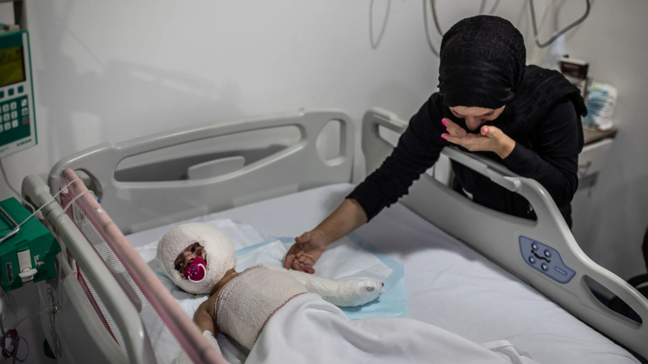 Fatima Skaiki försöker trösta sin dotter Ivana (2), men det är inte mycket hud mamman kan röra vid. Den lilla flickan blev allvarligt bränd i en attack i familjens by i södra Libanon. Ivana och storasystern lekte ute, berättar pappan, när en missil landade i grannskapet och sprängde det han misstänker var ett vapenlager gömt i ett garage.