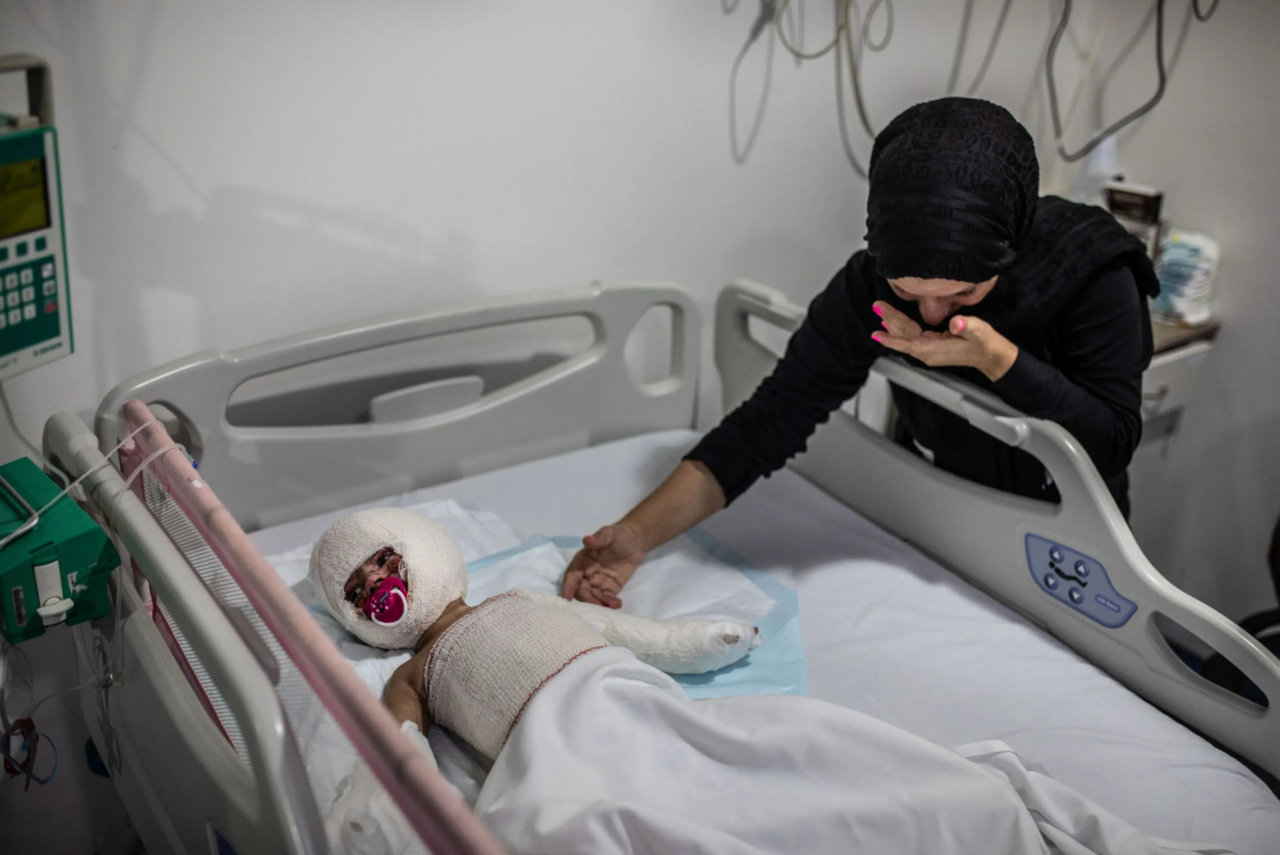 Fatima Skaiki försöker trösta sin dotter Ivana (2), men det är inte mycket hud mamman kan röra vid. Den lilla flickan blev allvarligt bränd i en attack i familjens by i södra Libanon. Ivana och storasystern lekte ute, berättar pappan, när en missil landade i grannskapet och sprängde det han misstänker var ett vapenlager gömt i ett garage.